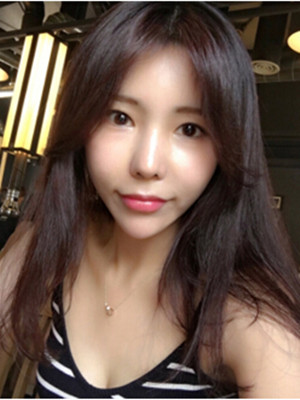 玻尿酸去除法令纹后人生明朗了 军美王世虎做的