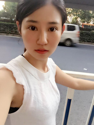 看了颜玲做的双眼皮多项整形 你们心动了没