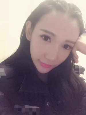 隆鼻整形做完之后人也美了 军美颜玲做的