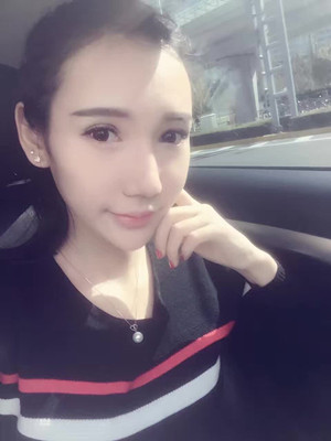 隆鼻整形做完之后人也美了 军美颜玲做的