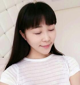 南京康美张让虎医生给我做的眼部综合整形，大家来看看怎么样