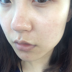 做了黑脸娃娃后，Duang的一下就变成“白雪公主”啦