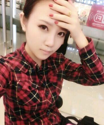 假体隆鼻15天后恢复果 杭州时光做的~