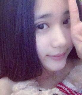 北京常好丽格割双眼皮一周啦~