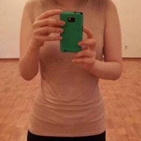 北京常好丽格腰腹吸脂后20天的感受 恢复日记来咯~