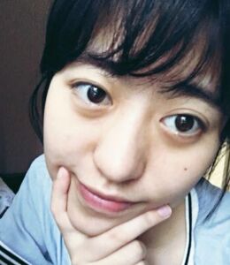 激光点痣不留坑不留疤，果棒棒哒