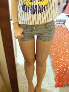 吸脂瘦大腿让我变回纤纤细腿