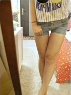 吸脂瘦大腿让我变回纤纤细腿