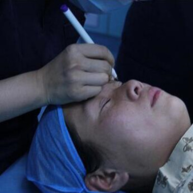 双眼皮手术让我单眼皮变双眼皮就是这么简单