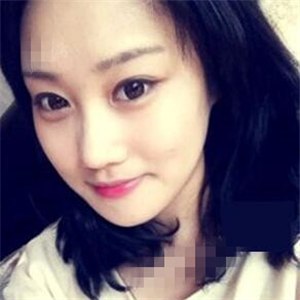 看看我磨下颌角整形手术恢复前后的对比图片，同学都说我像张馨予~~