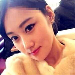 看看我磨下颌角整形手术恢复前后的对比图片，同学都说我像张馨予~~