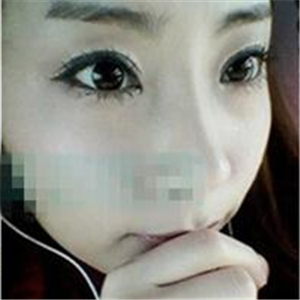 首尔丽格洪性范耳软骨隆鼻案例