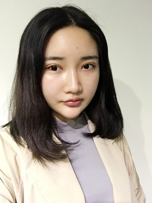 自体脂肪填充额头以后变化很大