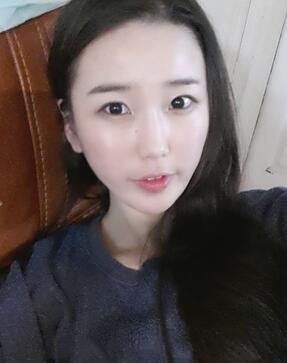 北京清木自体脂肪丰面颊2个月果分享