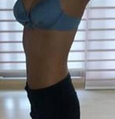 北京清木腰腹吸脂3个月感受