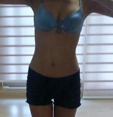 北京清木腰腹吸脂3个月感受