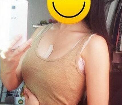 北京世熙自体脂肪隆胸2个月啦~