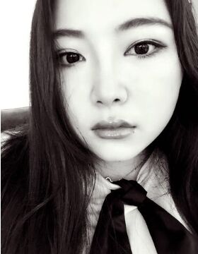 天津美莱吴胜做的硅胶假体隆鼻还垫鼻尖了