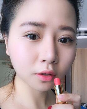 路卫国给我做隆鼻整形后鼻子变得特别秀丽