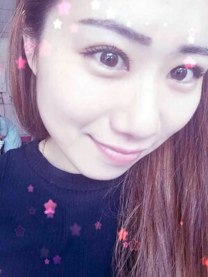 做了全切双眼皮和开内眼角，术后果较为满意