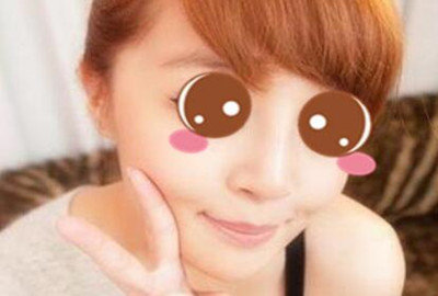 膨体隆鼻让我的颜值更上一层