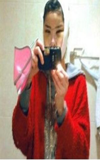 做了磨颧骨手术的我从小鸭子变成白天鹅 谢谢柳大烈教授