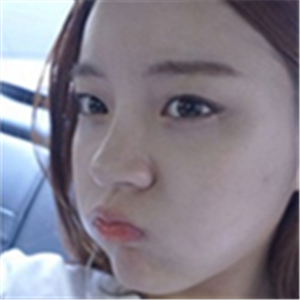 注射美白k氧注射针后一个疗程的果照片，你们看前后对比，变化很大吧~