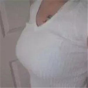 分享我水滴型假体隆胸手术恢复过程，还有前后对比果图片哦~