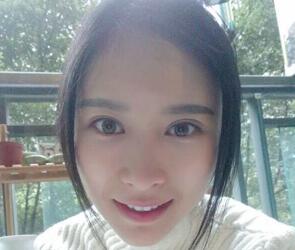 自体脂肪面部填充三个月了，恢复的很好，给你们看看果怎么样吧，是不是很美丽了~