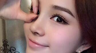 隆鼻整形后恢复图