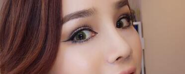 隆鼻整形后一个月恢复图