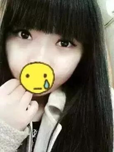 【真人案例】双眼皮手术后，见证我的美!