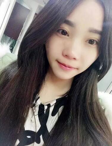 成都蜀尚蓉雅双眼皮恢复纪实 看看果怎么样