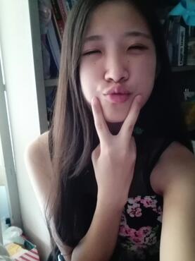 埋线双眼皮15天恢复记录