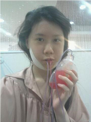 磨了下颌角和颧骨的我 变成小仙女了