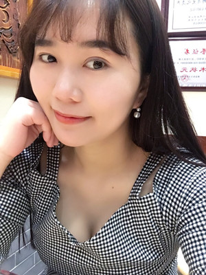 自体脂肪隆胸后变自信了 吴建明教授做的