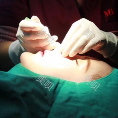 我的自体脂肪隆鼻后活脱脱的把我变成了网红了哈哈  美~~~