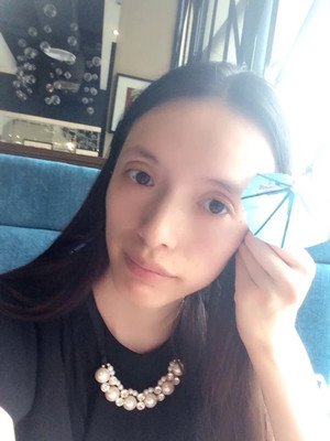 玻尿酸面部填充前后过程及对比图片，来看看果如何