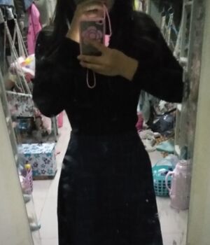 腰腹吸脂后腰线好看太多，肚子也小了