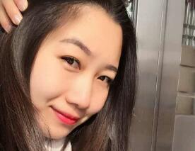 自体脂肪脸部填充脸部轮廓更协调