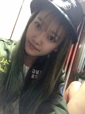 东方丽人陆忠凯做的注射瘦脸 脸变小了