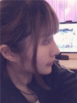 玻尿酸隆鼻后意想不到的果 陆忠凯做的