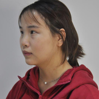 在苏州常春藤做的硅胶假体隆鼻为大家分享下我的恢复全过程吧