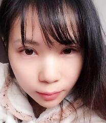 长沙美之峰重睑+开眼角恢复过程图