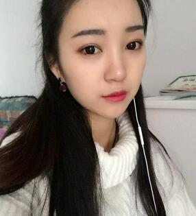 长沙美之峰割双眼皮3个月了