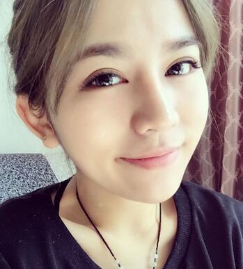 长沙美之峰假体隆鼻恢复日记