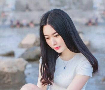 双眼皮开眼角修复眼睛终于变得正常好看了