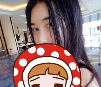 双眼皮开眼角修复眼睛终于变得正常好看了