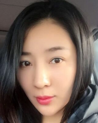 埋埋蛋白线.提升整个面部年轻很多，小V脸也出来了