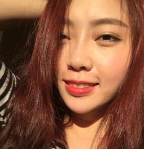 自体脂肪隆鼻、垫下巴、丰苹果肌前后对比图和恢复过程分享